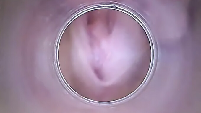 18-Year-Old Amateur Shows Off Her Dry Vagina And Cervix